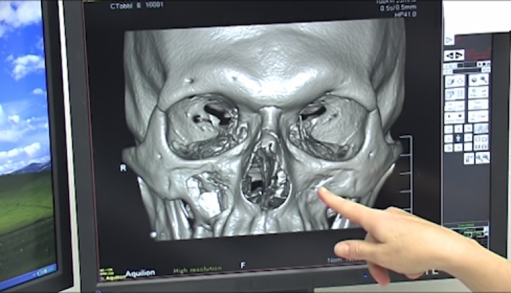 O den otevřených dveří na novoměstské radiologii byl ze strany pacientů velký zájem