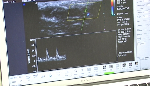 Na žďárské poliklinice funguje Angiologická ambulance